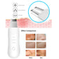 Ultrasonic Facial Skin Scrubber – Deep Cleansing, Peeling, Blackhead Removal & Facial Massage Device