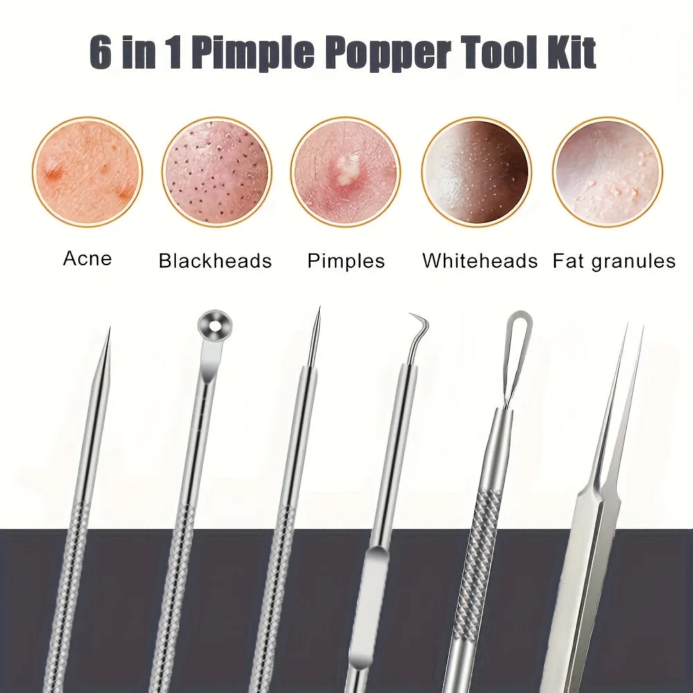 Kit Anti-Acné 6 Pièces – Extracteurs de Points Noirs, Nettoyage des Pores, Soin Visage