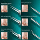 Professional Blackhead Removal Tool Kit – 11-Piece Pore Cleansing Set